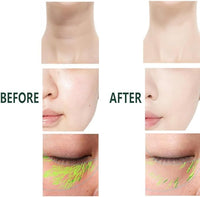 GlowLift 3-in-1 Facial Massager